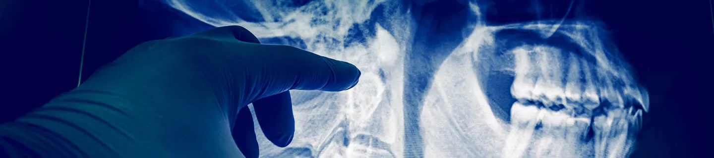 Case Study - HCL DX - Finceramica Medical Devices - Banner 2